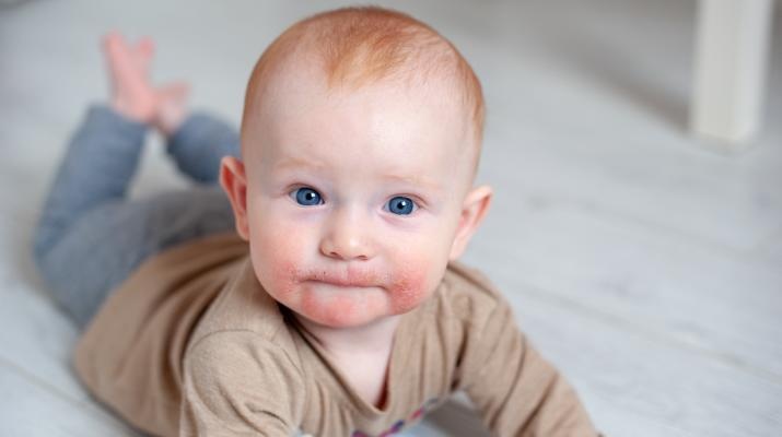 Dau hieu da nhay cam o tre so sinh anh 2