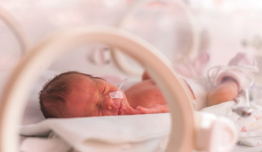 Nhung bien chung nguy hiem o tre sinh non hinh anh