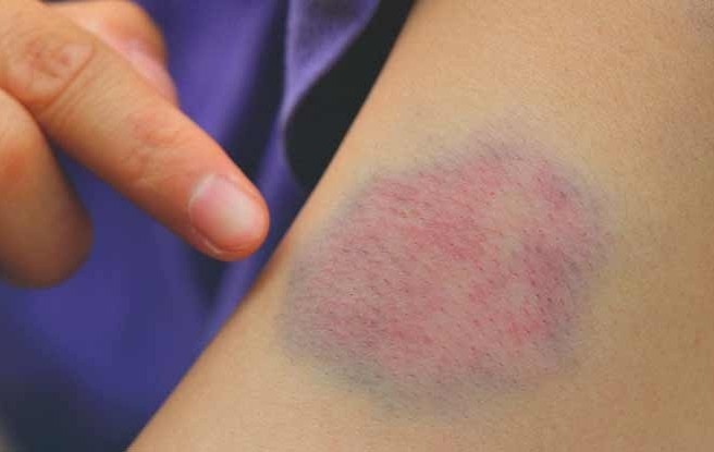 Dau hieu canh bao ban can bo sung vitamin C hinh anh