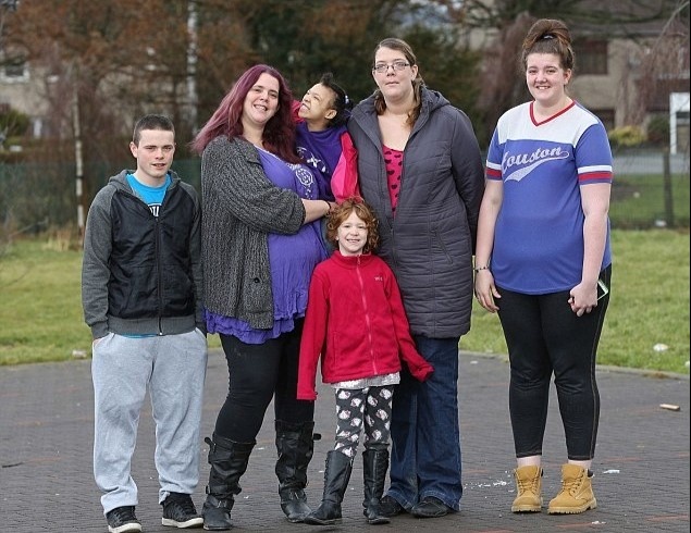 Hoi chung Marfan anh 1