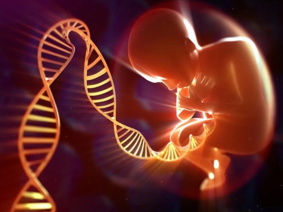 Hoi chung Marfan anh 3