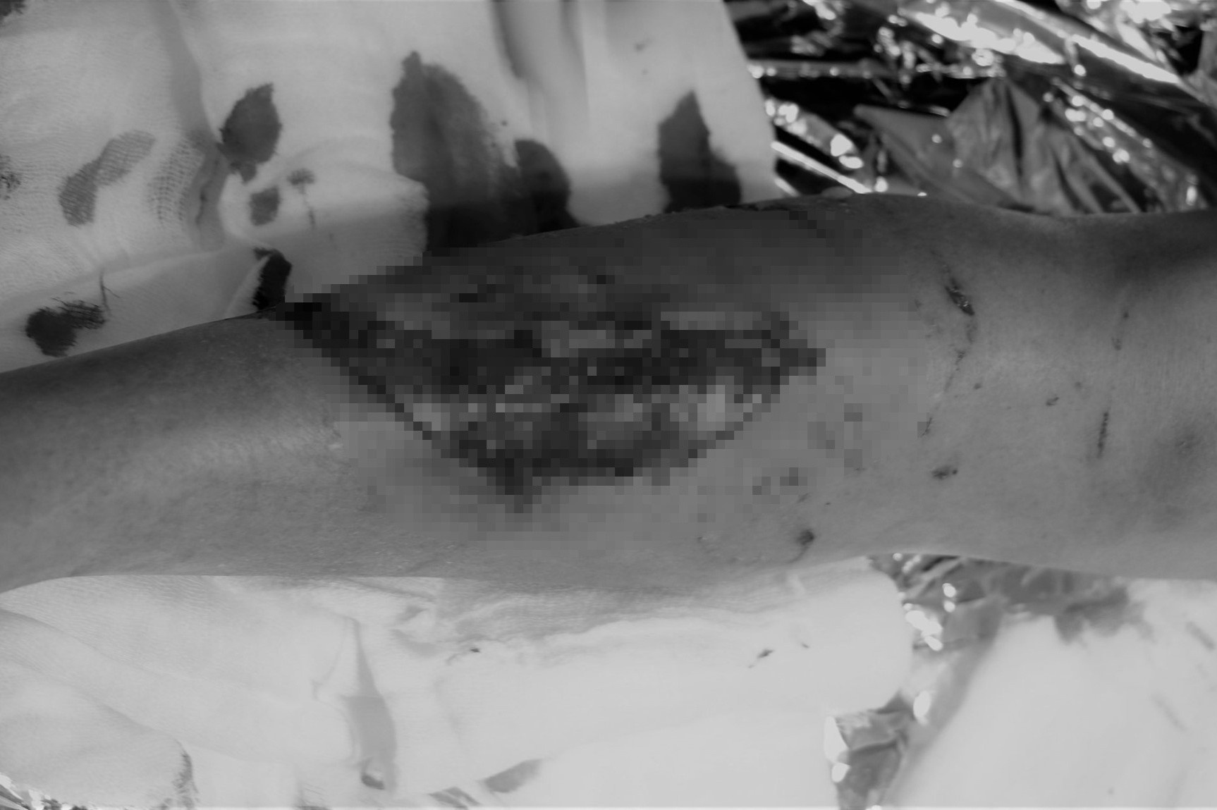 Nguoi phu nu bi cho pitbull can anh 1