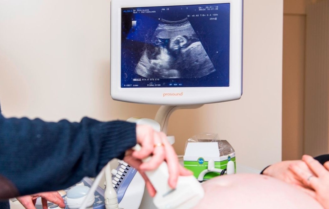 Khang the chong Covid-19 o phu nu mang thai anh 1