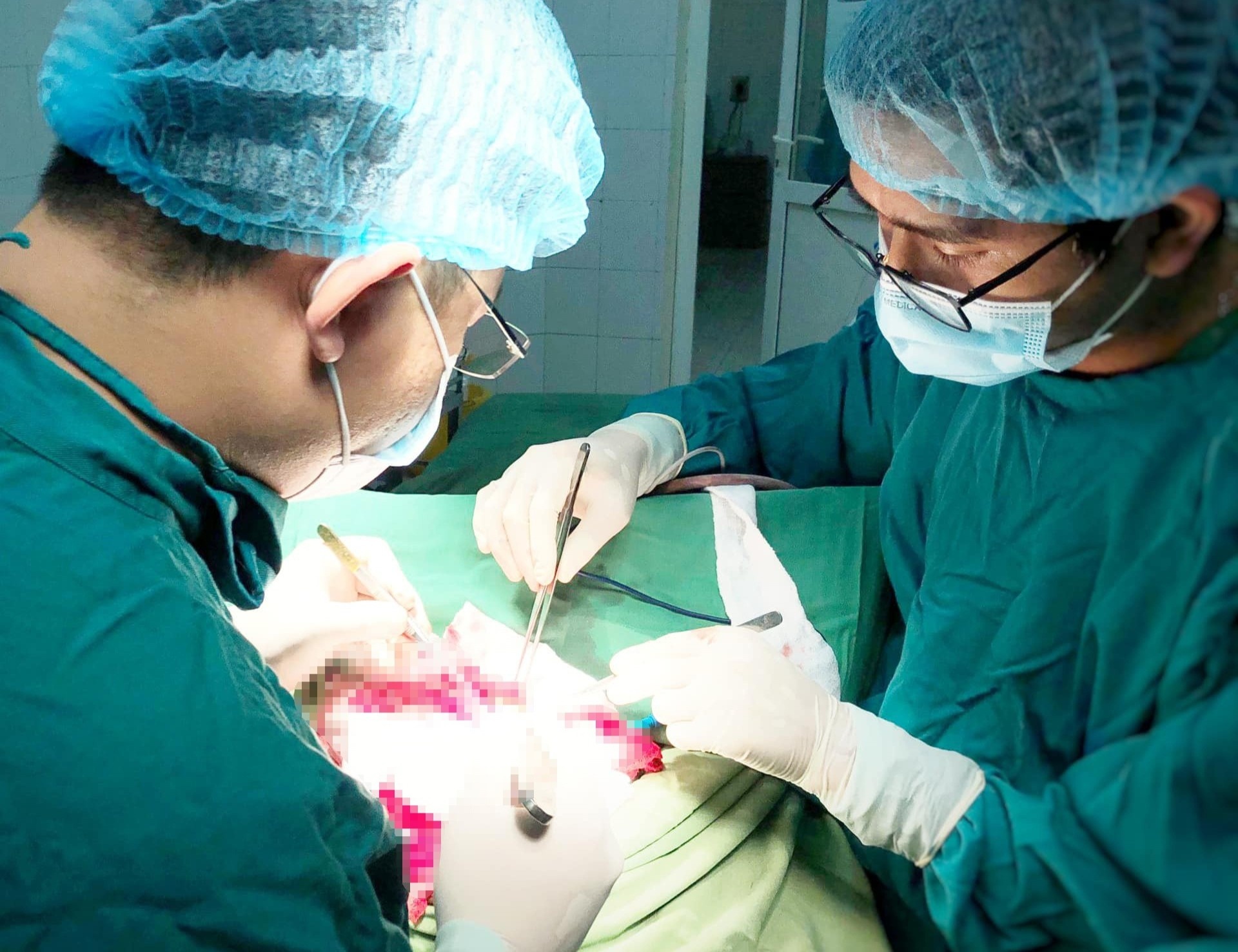 Chấn thương sọ não vì ngã cầu thang ảnh 1 Chan thuong so nao vi nga cau thang anh 1
