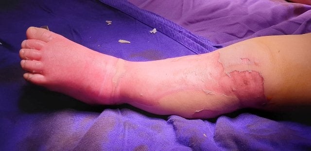 Tu vong do dap la chua bong anh 1