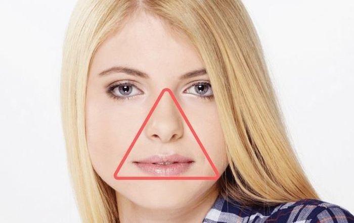 Nan mun o vung 'tam giac tu than' tren mat nguy hiem nhu the nao? hinh anh