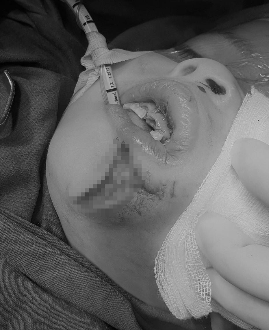 Be trai bi cho can rach mat anh 1