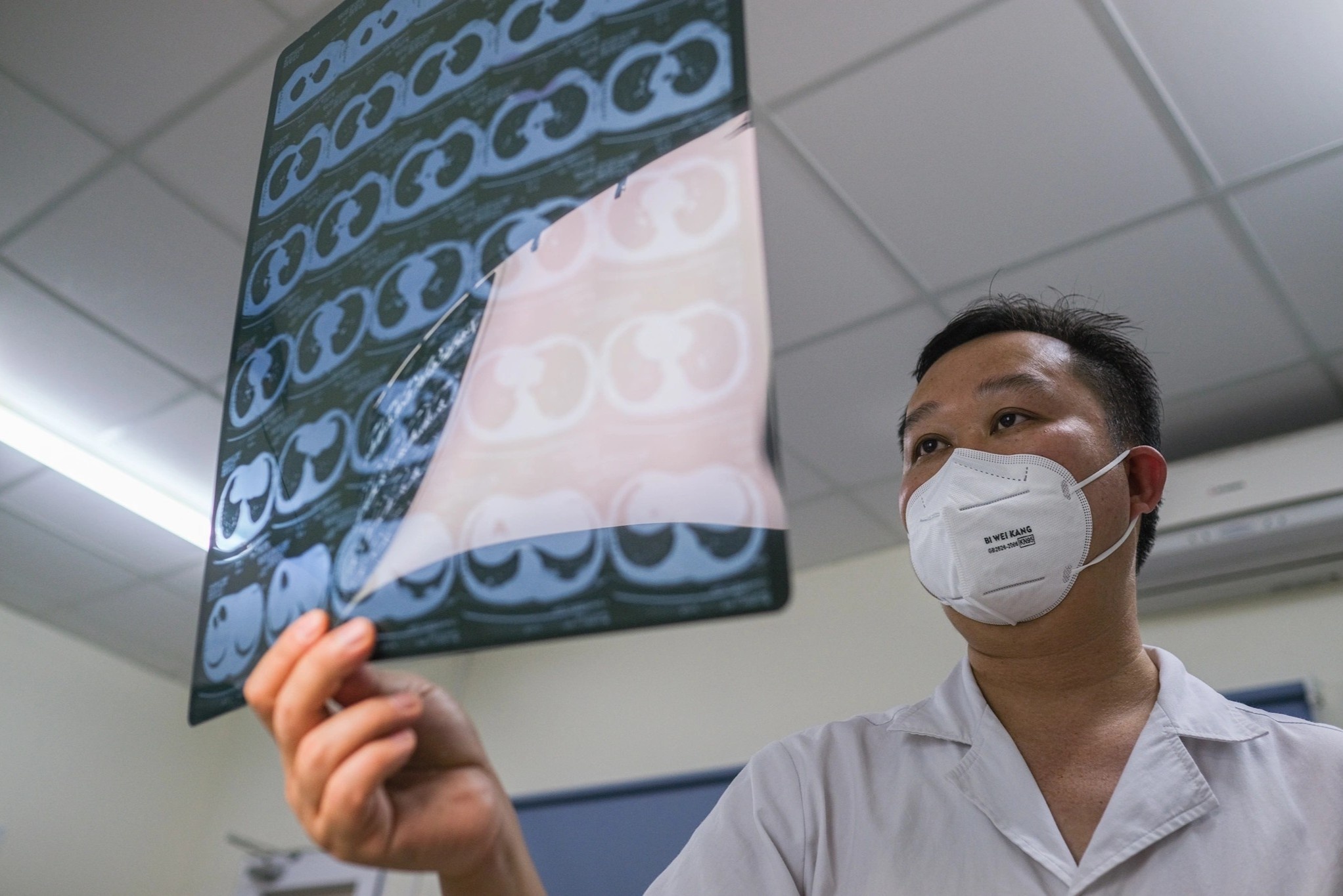 Suc khoe mot benh nhan Covid-19 duoc tien luong xau hinh anh