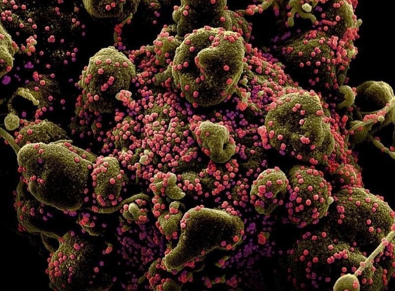 Dot bien cua virus SARS-CoV-2 anh 1