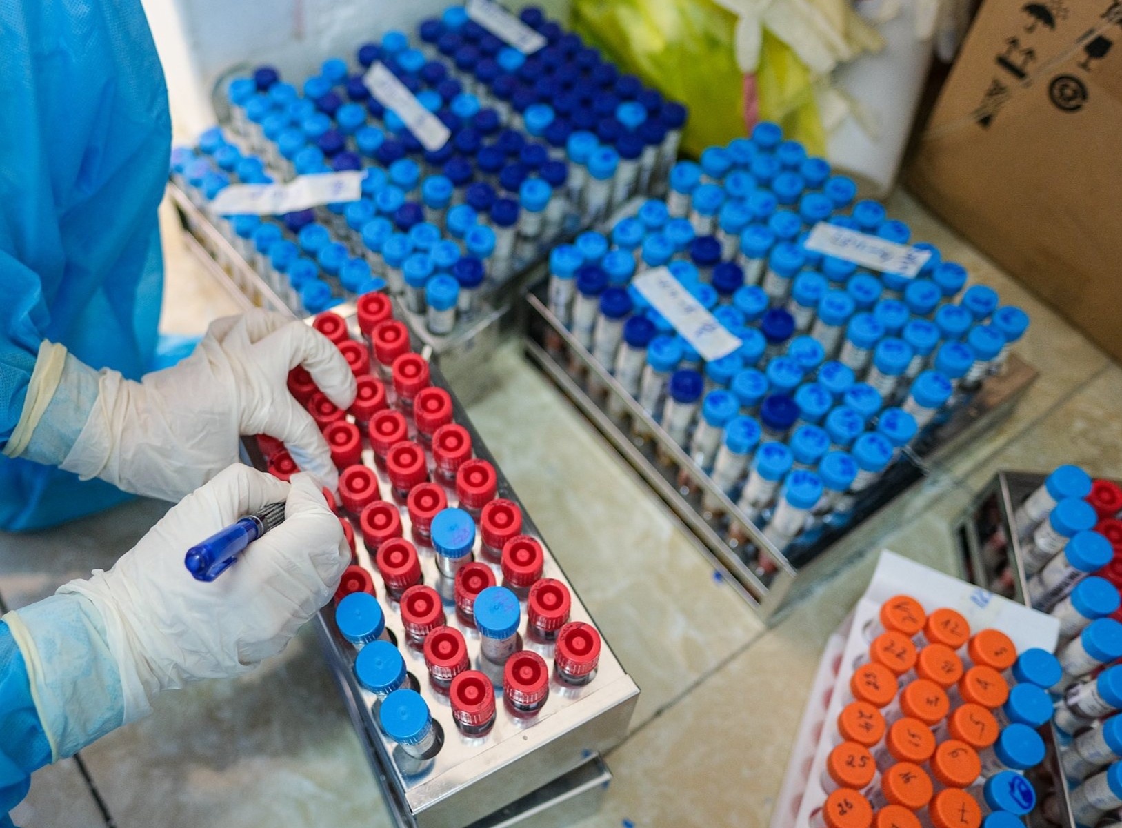 70% benh nhan Covid-19 tai Bac Giang khong co trieu chung hinh anh