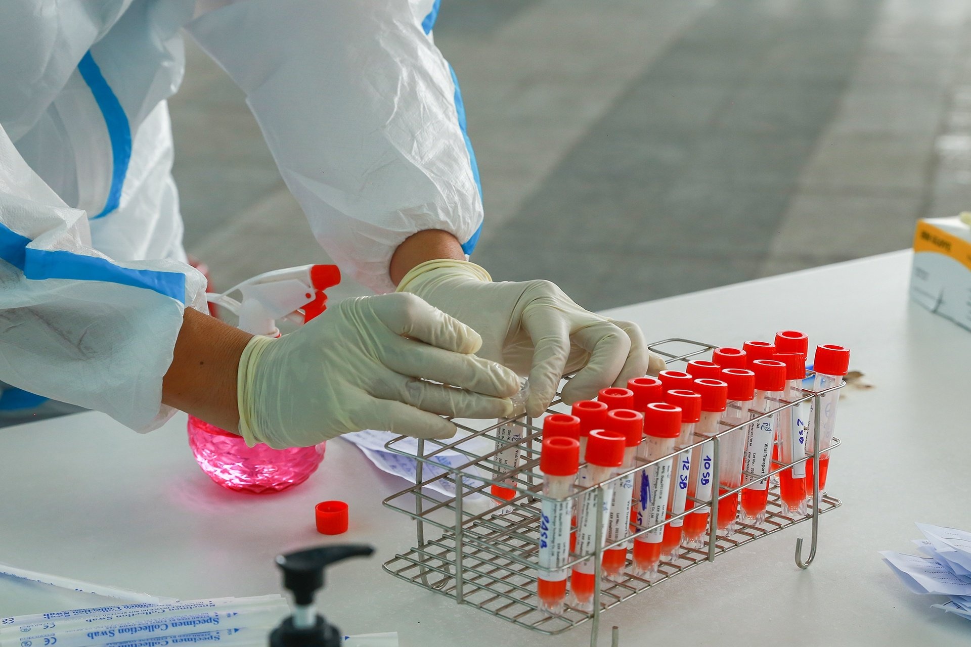 25 benh nhan Covid-19 nguy kich hinh anh