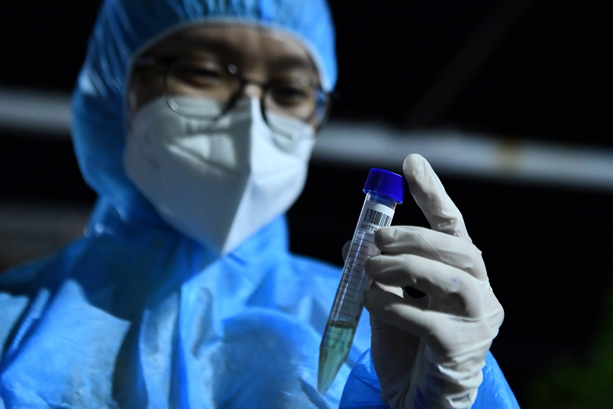 Phat hien dot bien gene trong 4 mau benh pham Covid-19 hinh anh