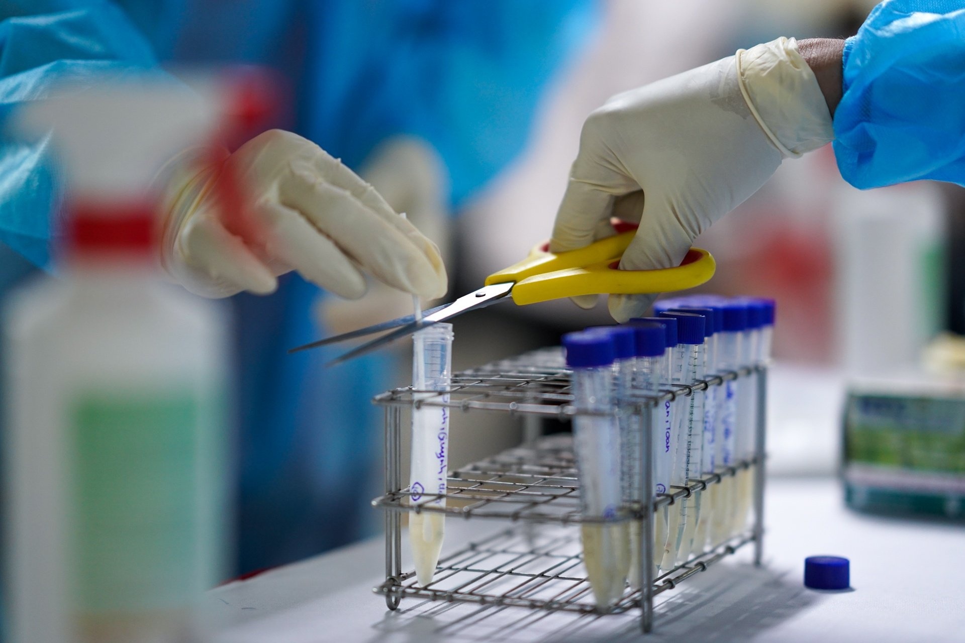 Benh nhan nhiem nCoV 76 tuoi tu vong hinh anh