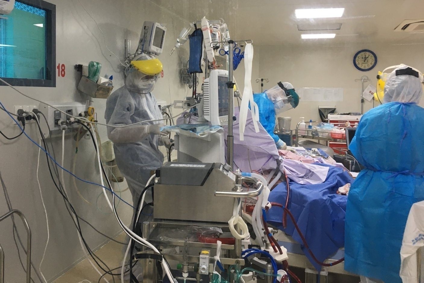 44 benh nhan Covid-19 nguy kich hinh anh