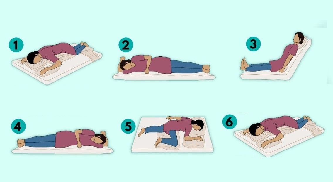 Tư thế nằm giúp bệnh nhân Covid-19 dễ thở ảnh 1 Tu the nam giup benh nhan Covid-19 de tho anh 1
