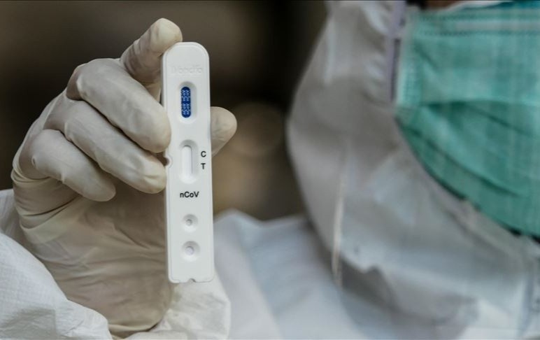 Khan truong bao cao gia ban test xet nghiem Covid-19 hinh anh