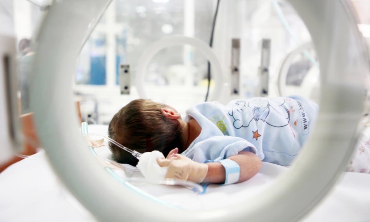 Dac diem mac Covid-19 o tre so sinh hinh anh