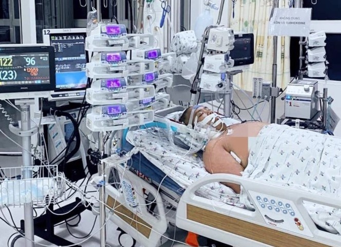 Mot benh nhi Covid-19 tai TP.HCM duoc dieu tri het 1,1 ty dong hinh anh