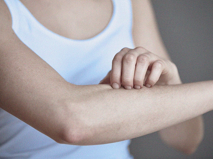 Dau hieu phat ban tren da hau Covid-19 can chu y hinh anh