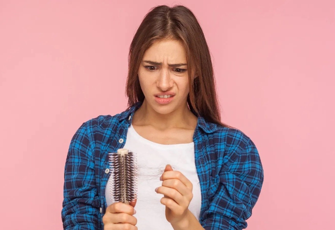 Cach khac phuc tinh trang rung toc hau Covid-19 hinh anh