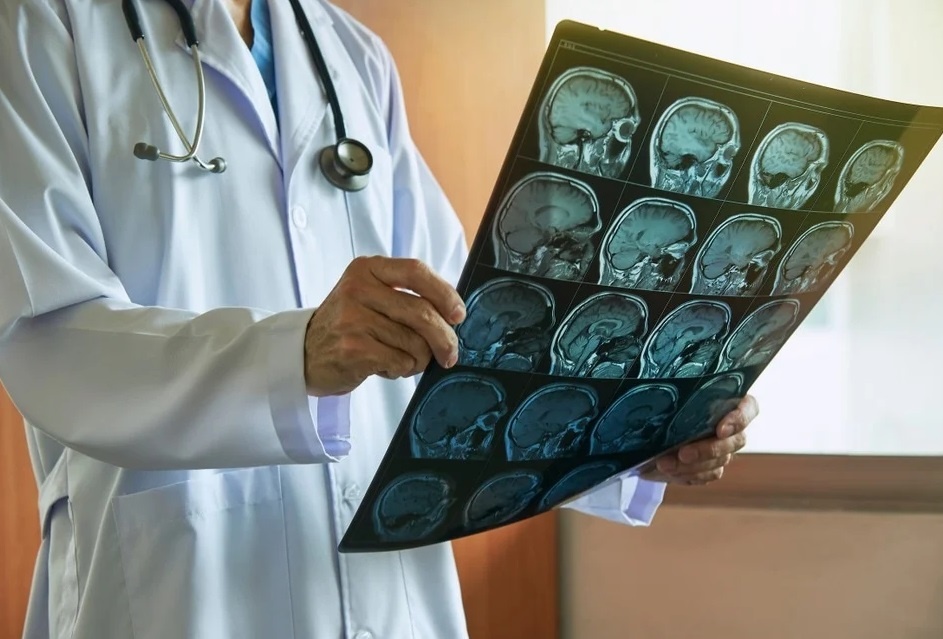 Ton thuong nao bo o F0 sau khi khoi Covid-19 hinh anh