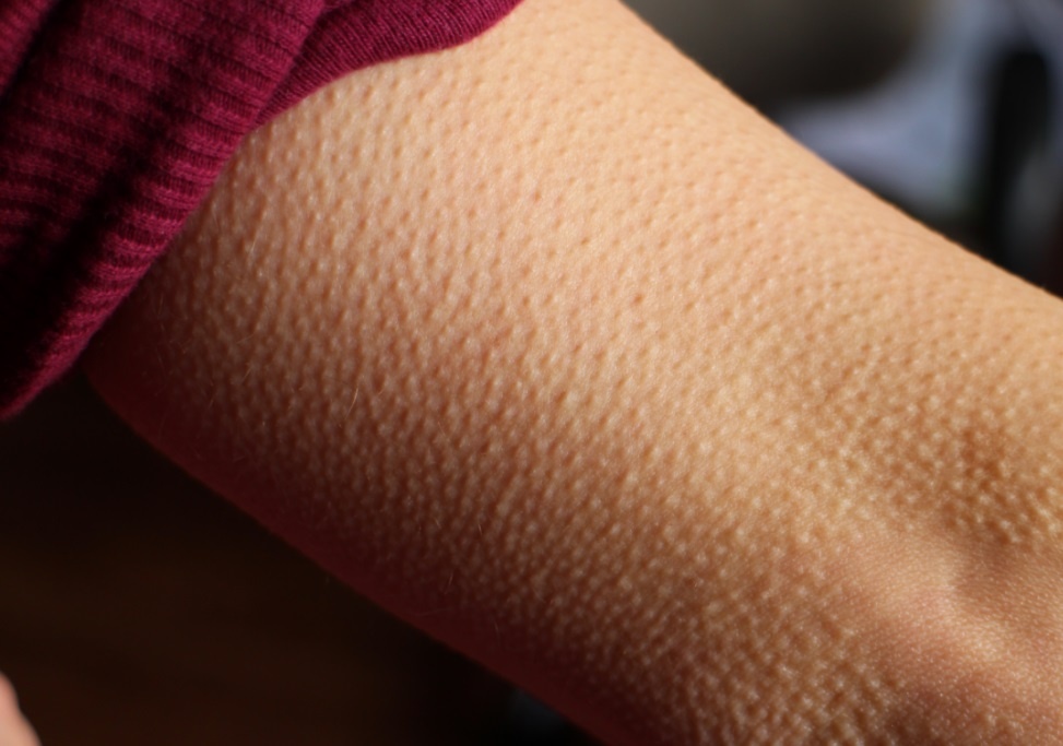 Noi da ga va nhung phan ung thu vi cua co the hinh anh