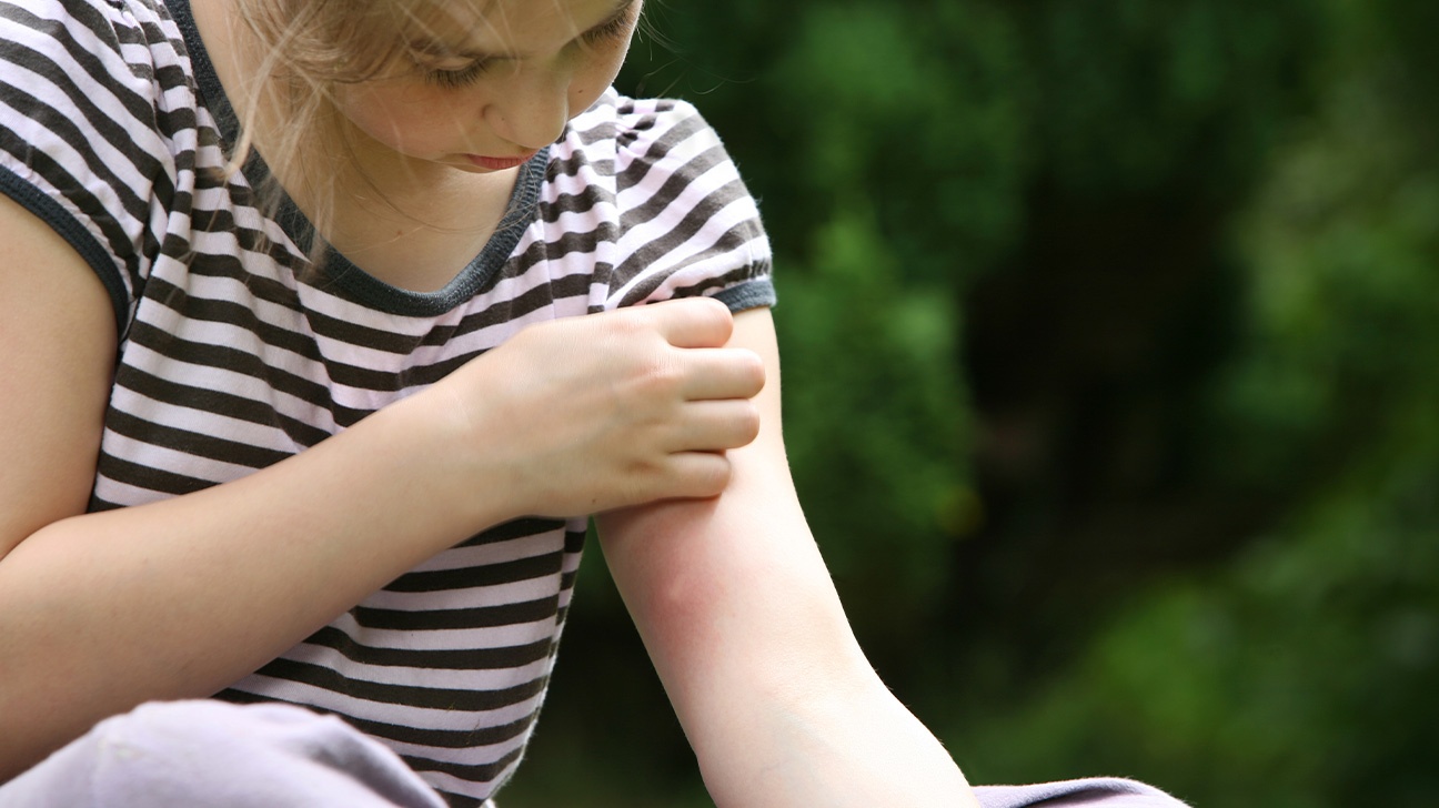 Su that ve sot xuat huyet anh 2