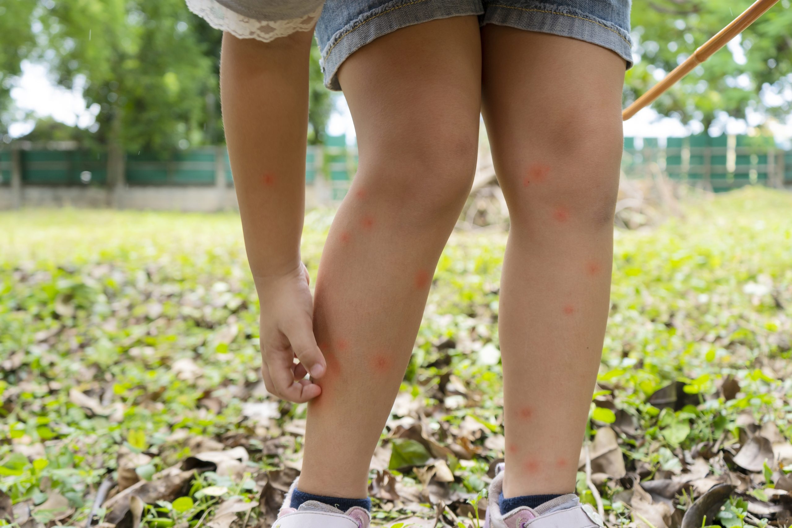 Ngan ngua sot xuat huyet anh 1