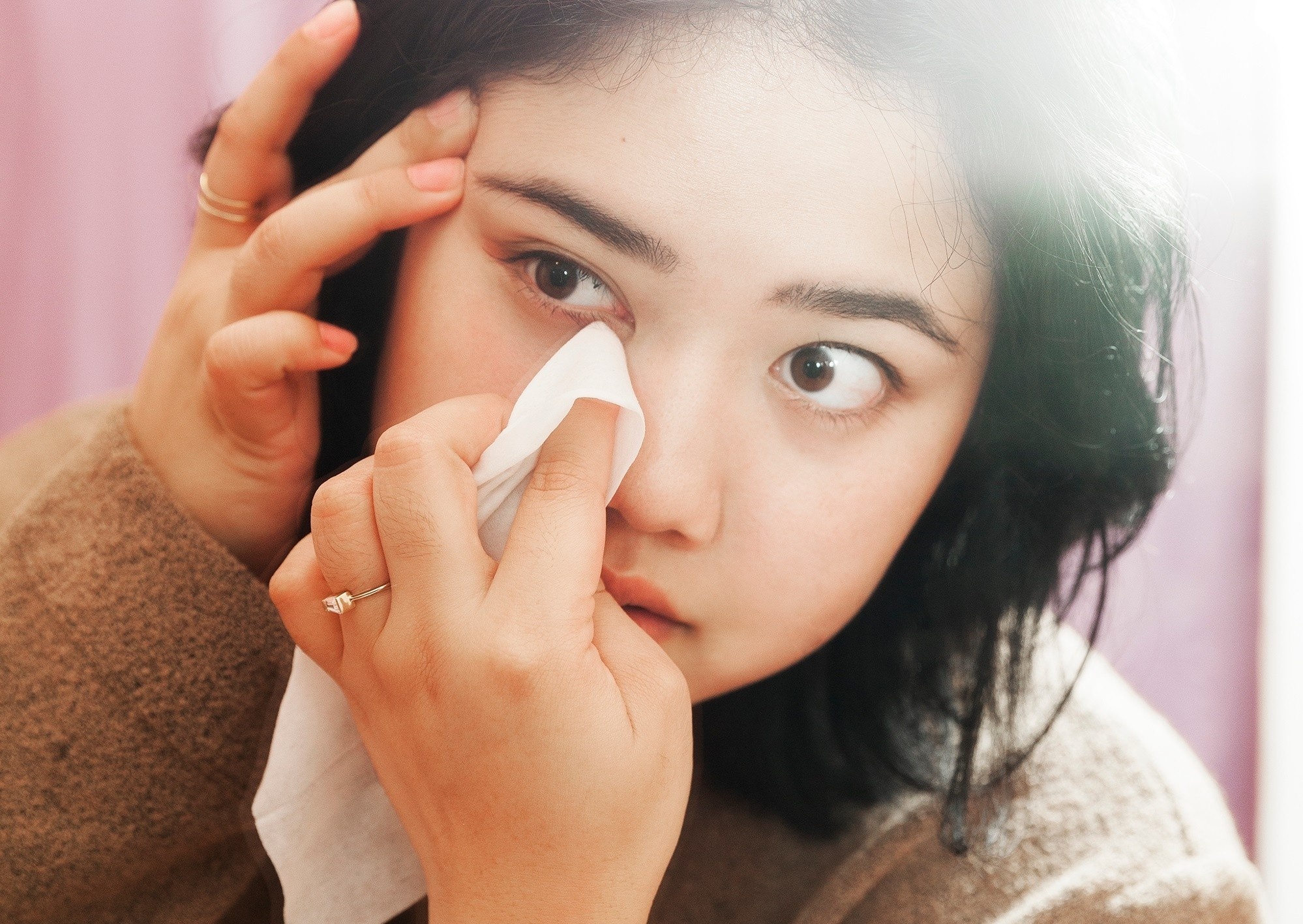 Benh dau mat do anh 1