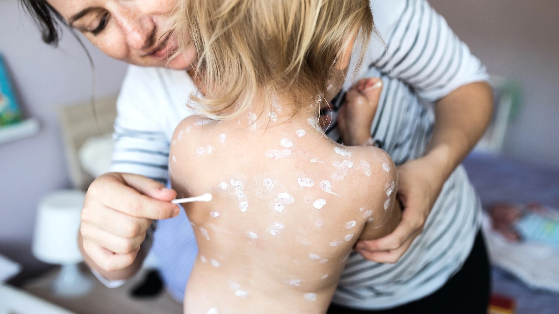 Tre bi thuy dau anh 1