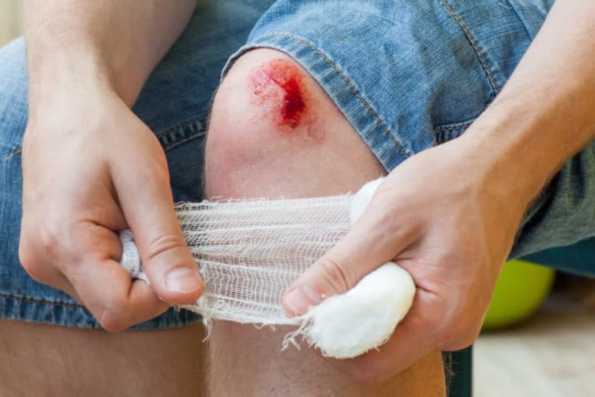 Bien chung nguy hiem cua benh uon van hinh anh