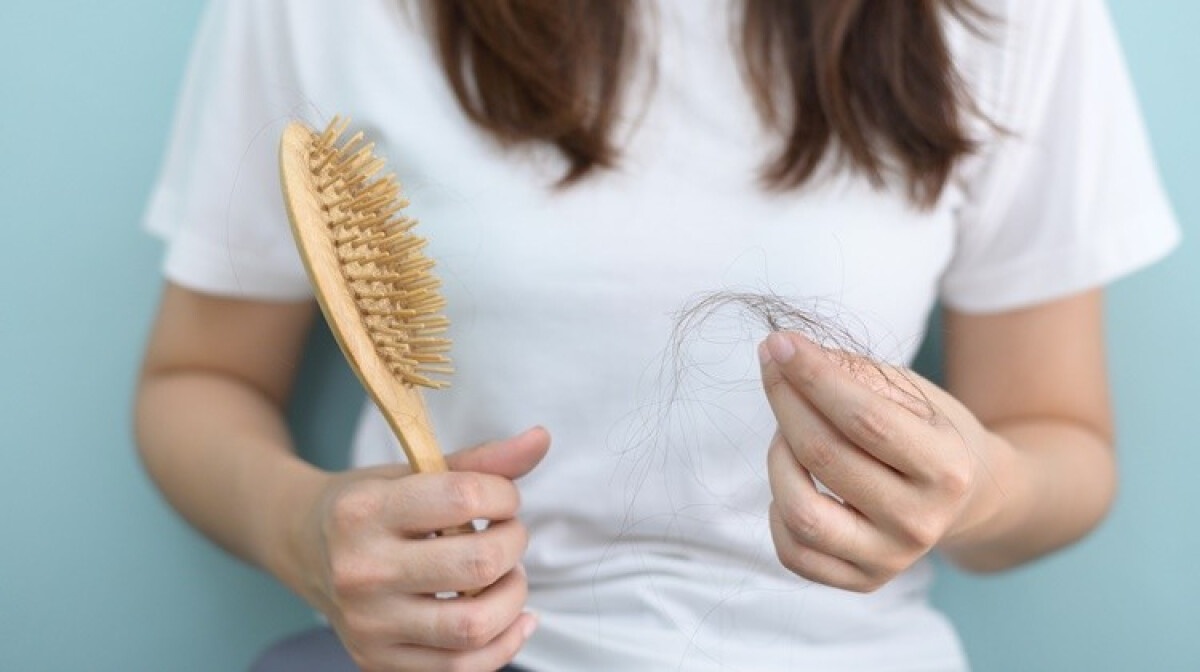 Rung toc sau sinh anh 1