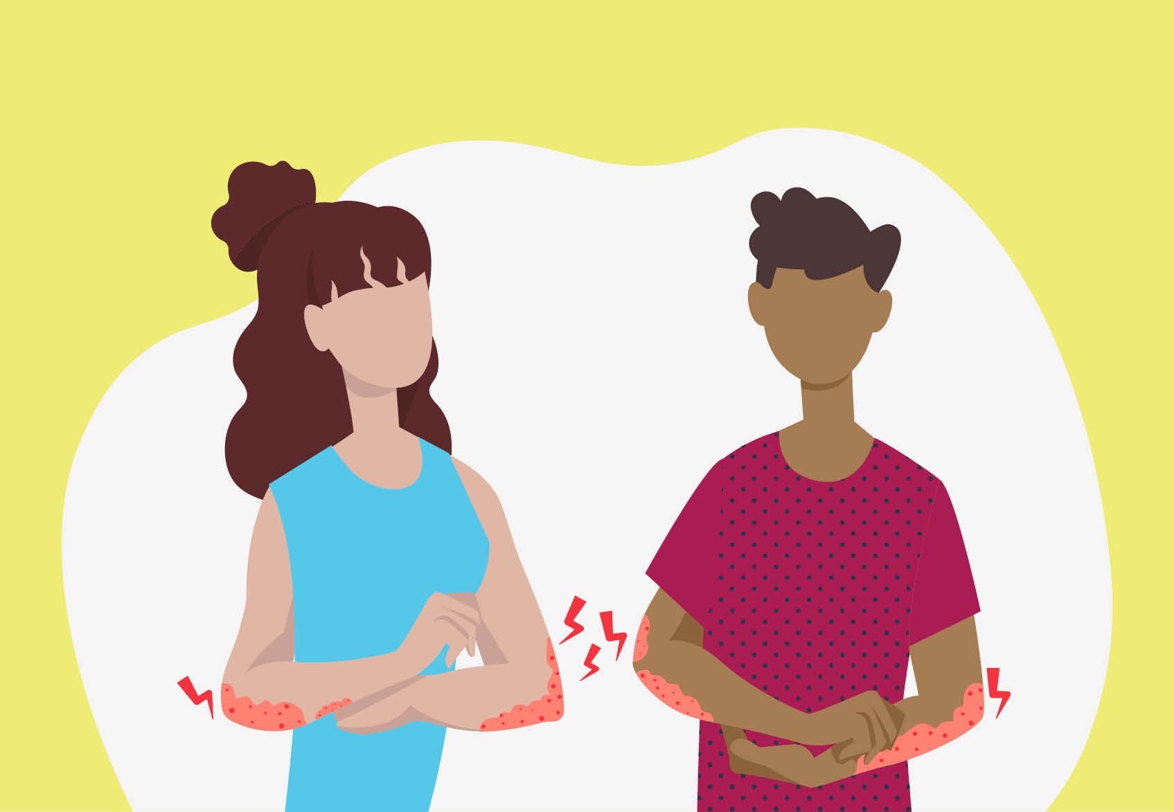 Ngua do do mo hoi anh 1