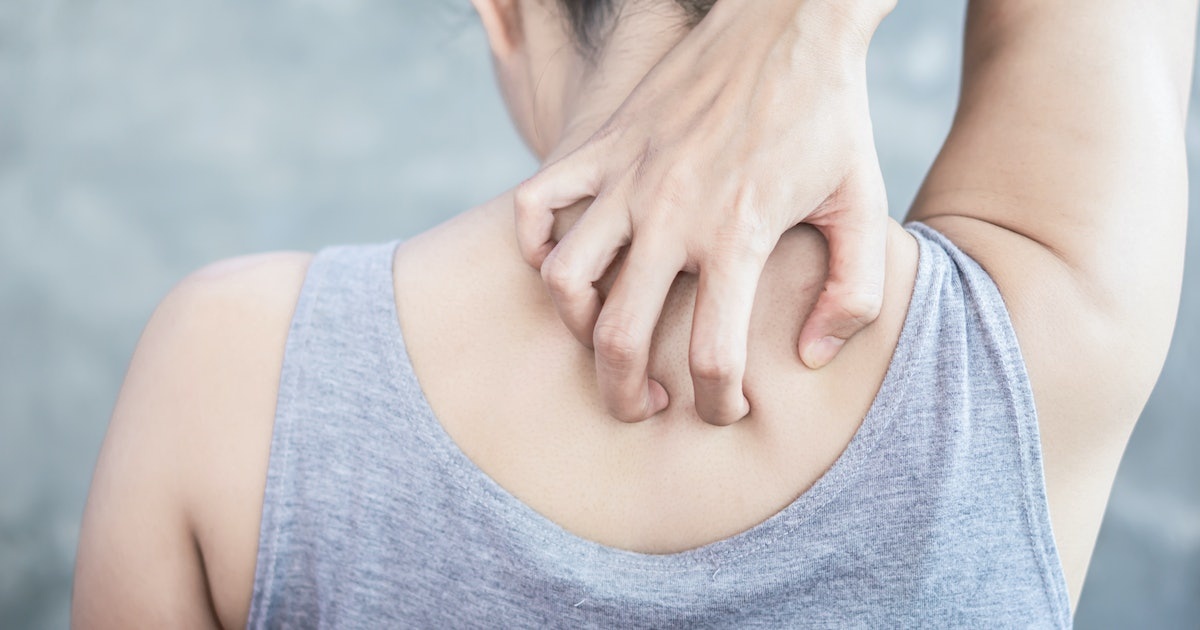 Cach giam ngua do do mo hoi hinh anh