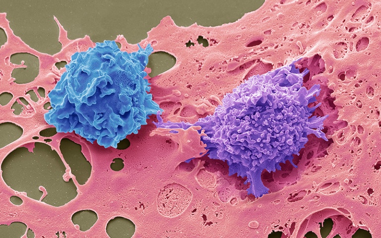 Nhung su that ve benh viem gan sieu vi hinh anh