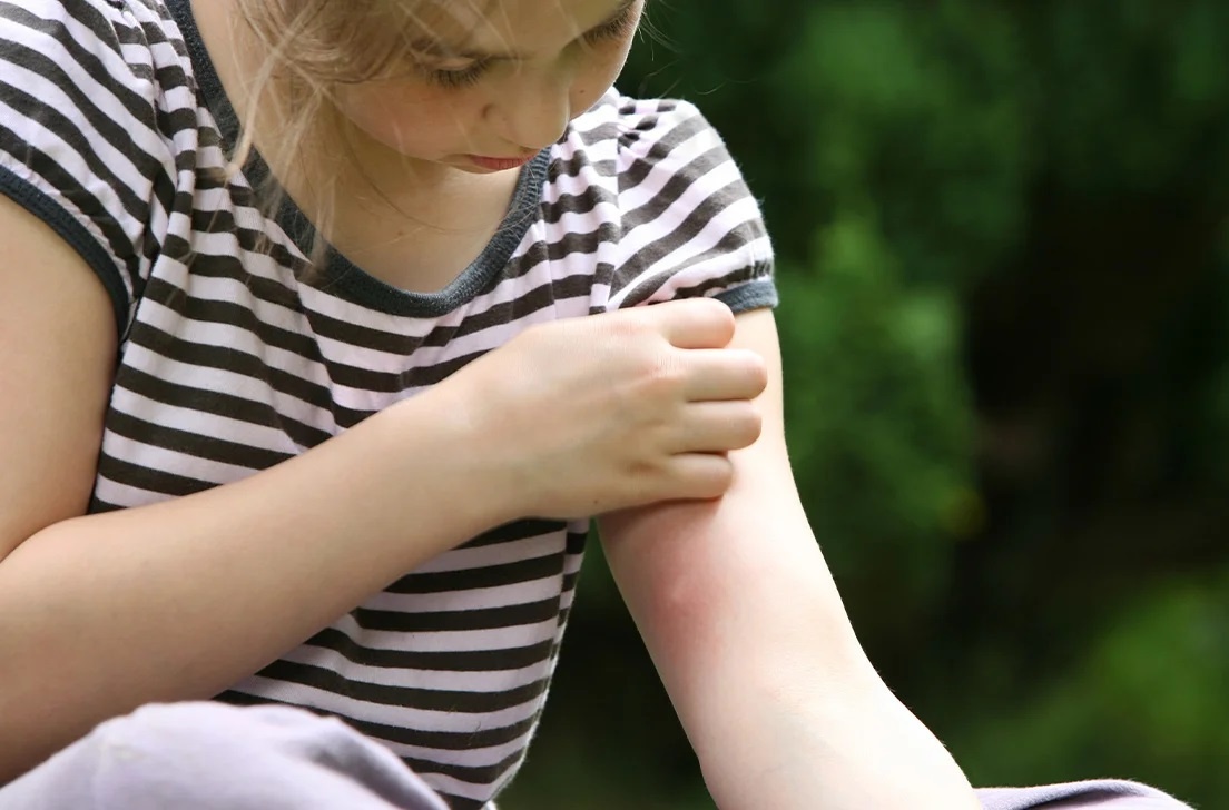 Ban co the mac sot xuat huyet nhieu lan? hinh anh