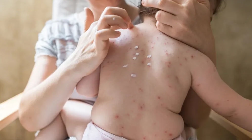 Co ai bi thuy dau den 2 lan? hinh anh