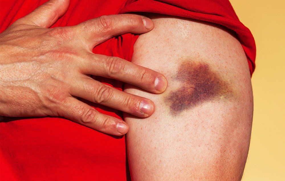 Dau hieu gan bi nhiem doc, can thanh loc ngay hinh anh