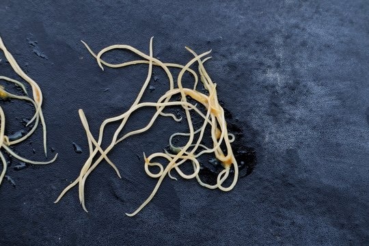 Ai co nguy co nhiem giun kim cao nhat? hinh anh