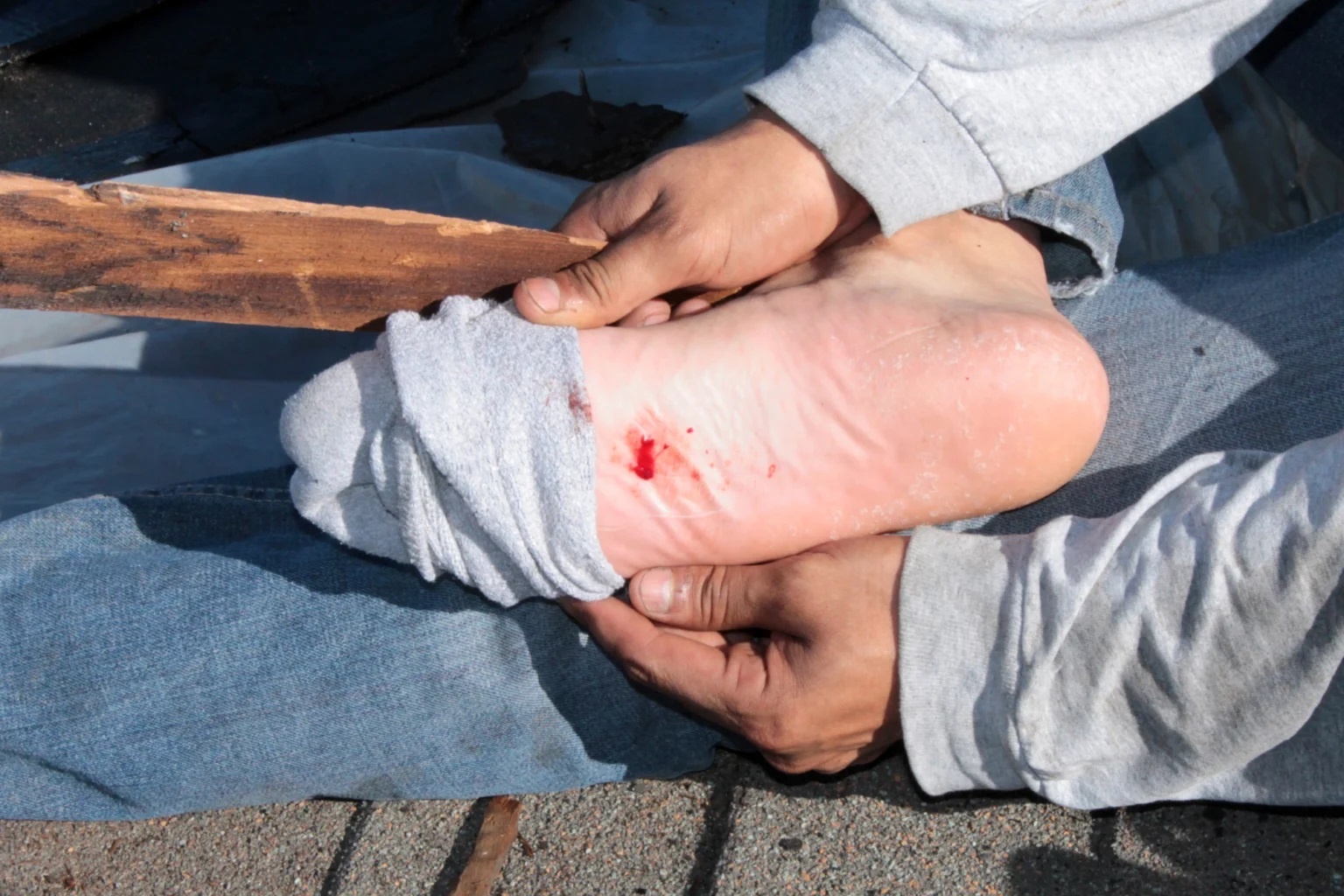 Bat can giam vat nhon tren duong, nguy co mac benh gi? hinh anh