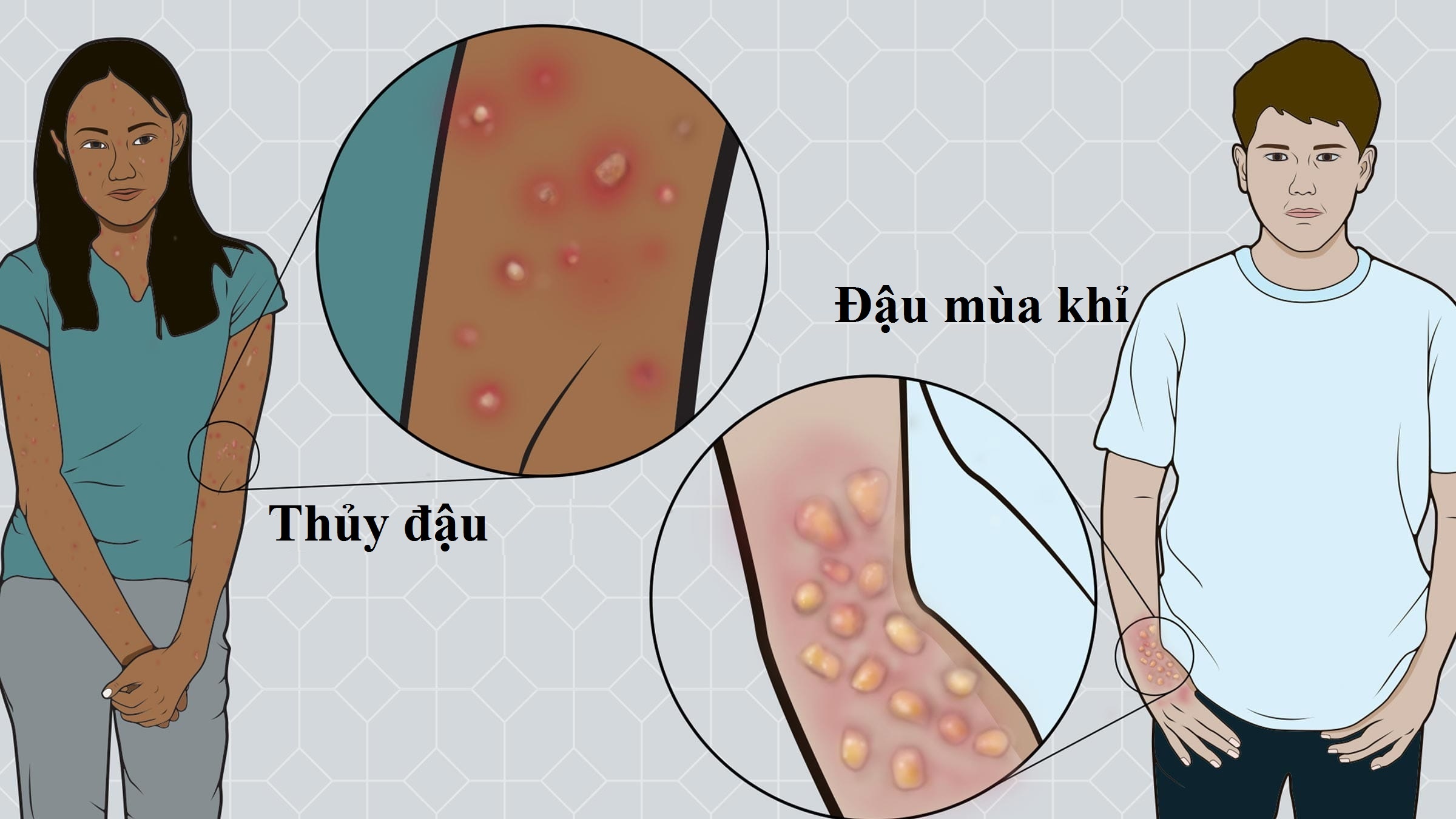 Dau hieu dau mua khi anh 1