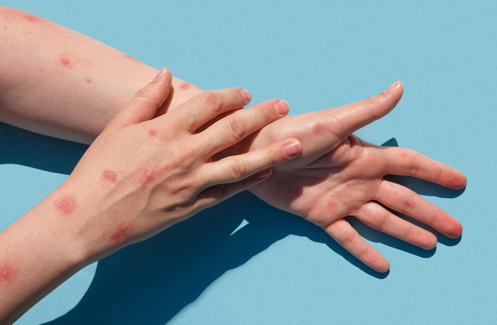 Phan biet thuy dau va dau mua khi hinh anh