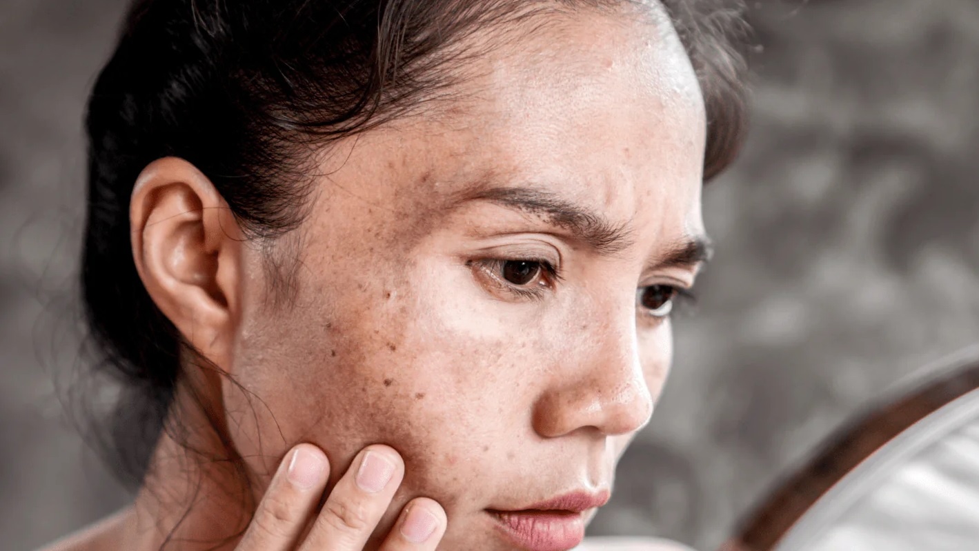 Bo phan chuyen den anh 1