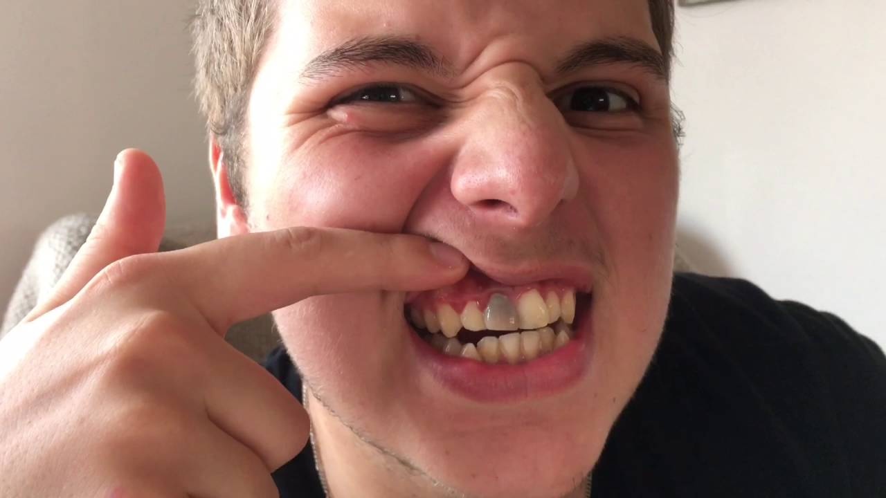 Bo phan chuyen den anh 4