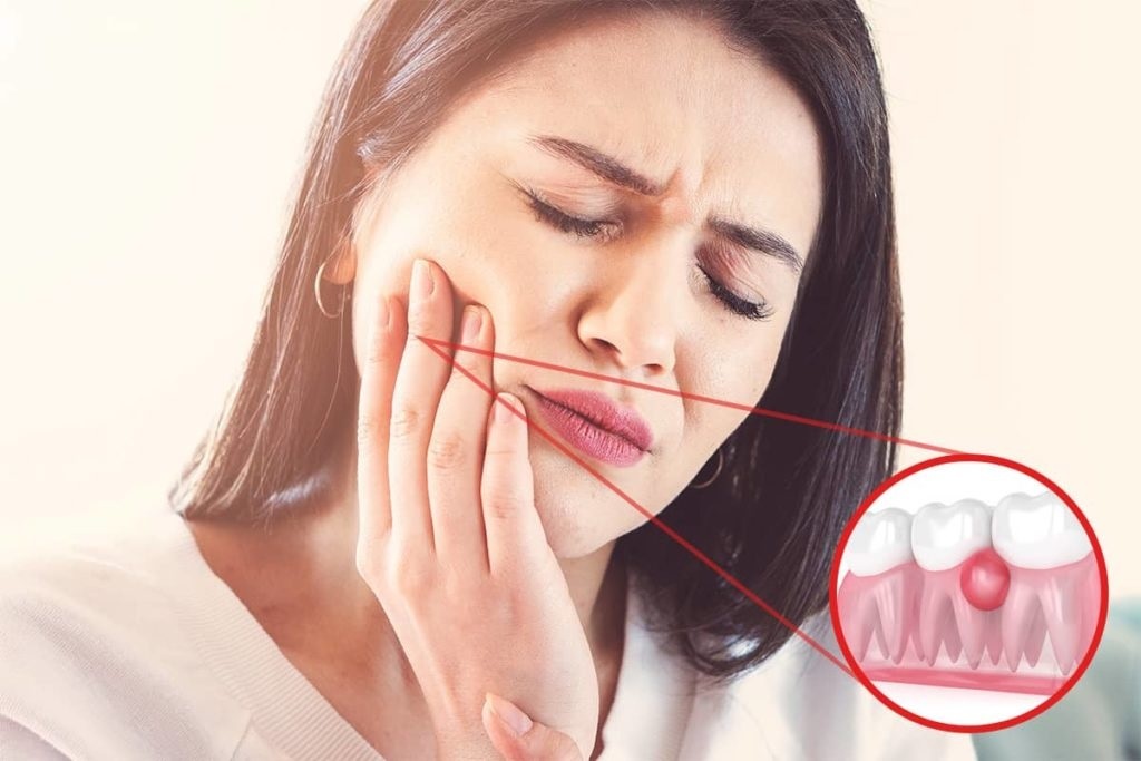 Bất thường ở răng miệng ảnh 5 Bat thuong o rang mieng anh 5