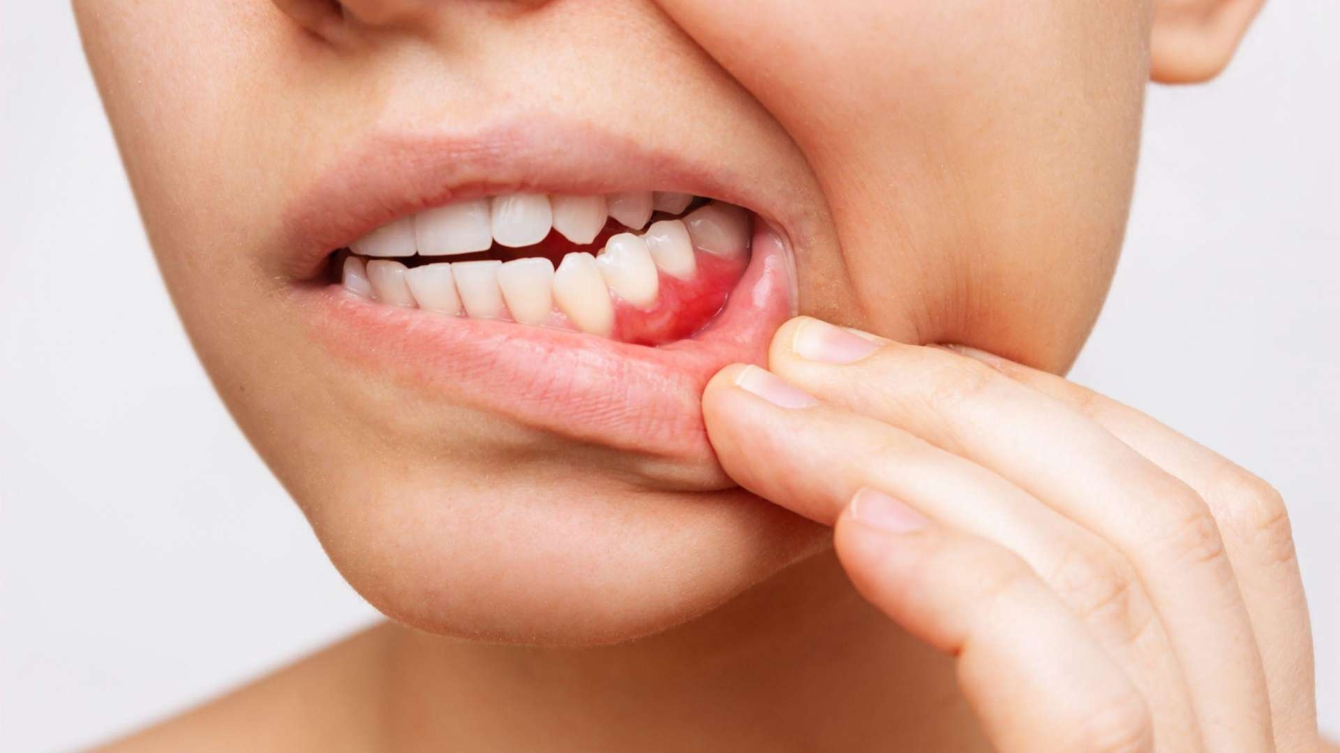 Bất thường ở răng miệng ảnh 3 Bat thuong o rang mieng anh 3