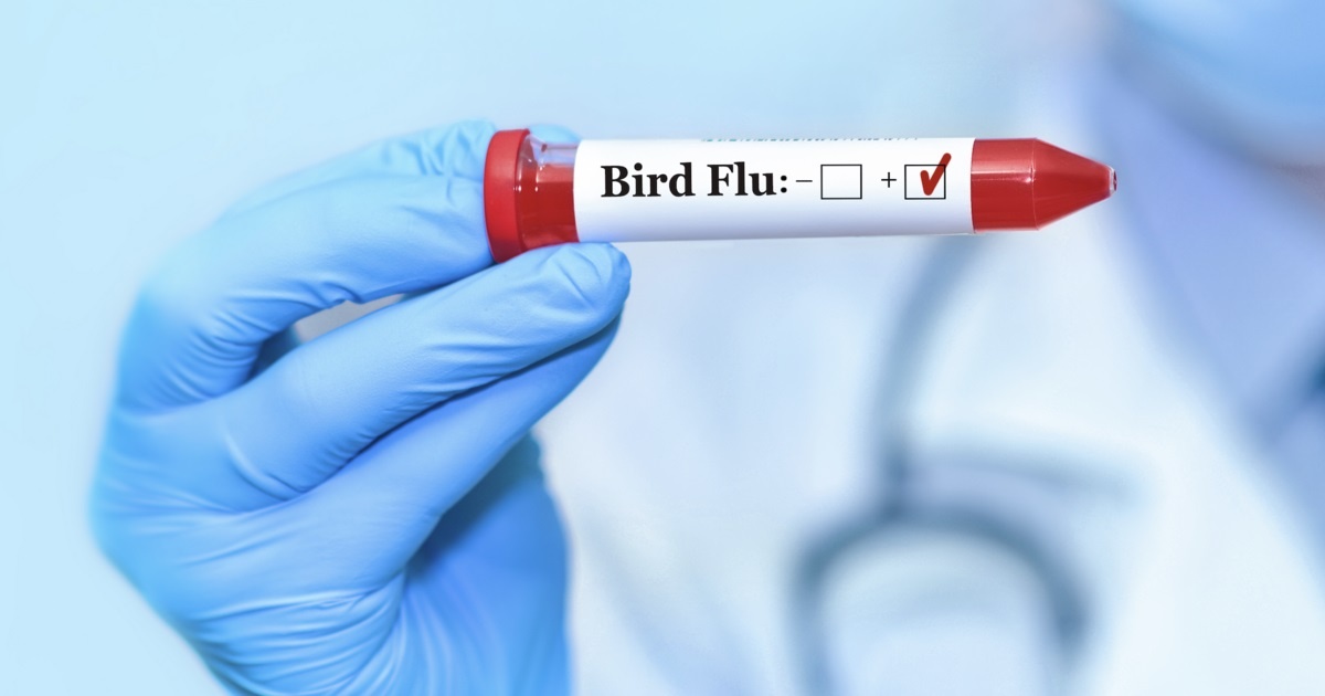 Noi dau tien tren the gioi tiem vaccine cum gia cam cho nguoi hinh anh