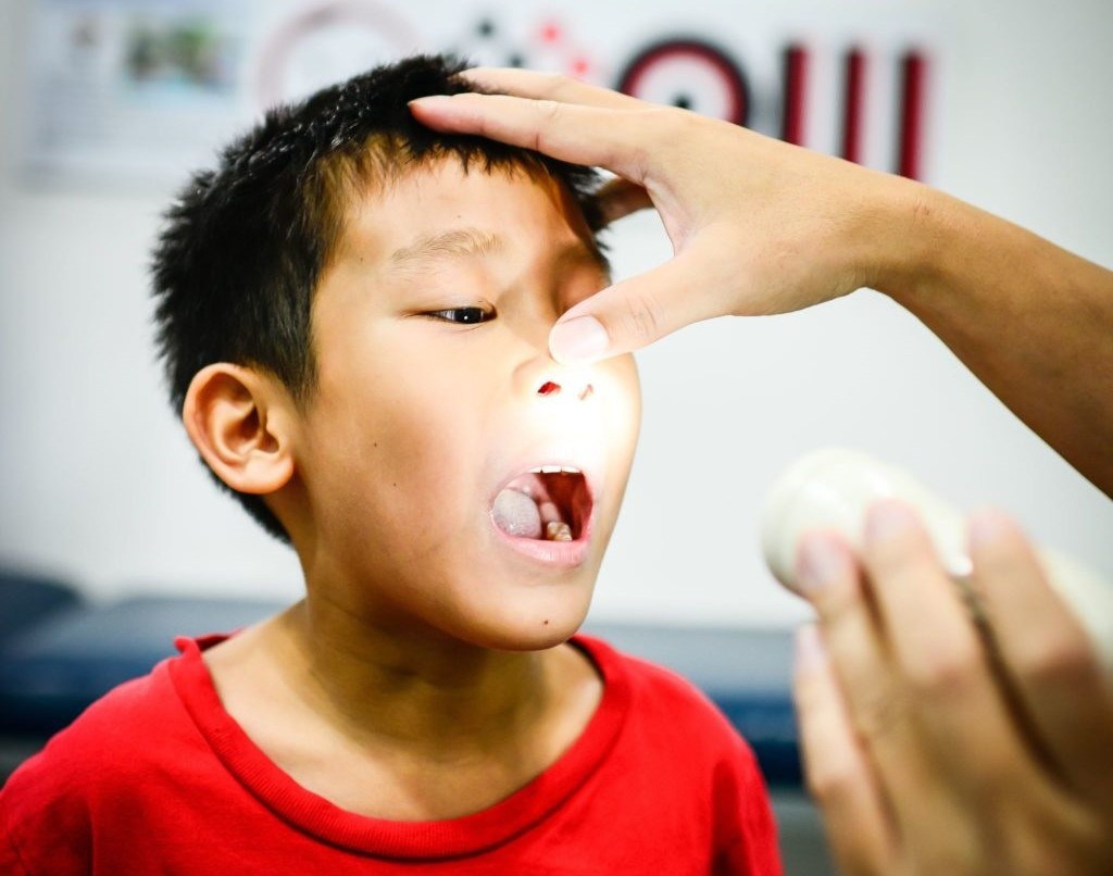 Ly do benh bach hau gay lo ngai hinh anh