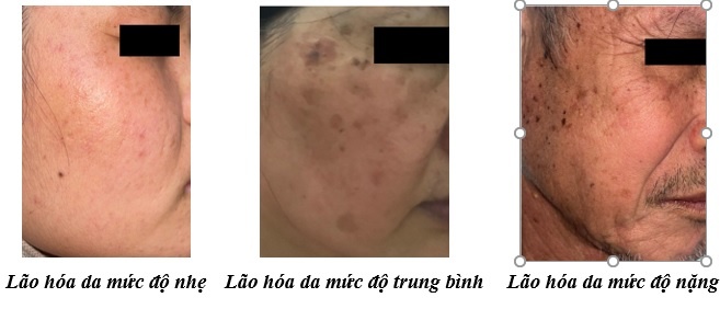 Ly do lao hoa da anh 1