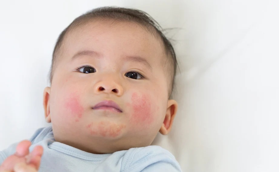 Nguyen nhan gay cham sua o tre hinh anh